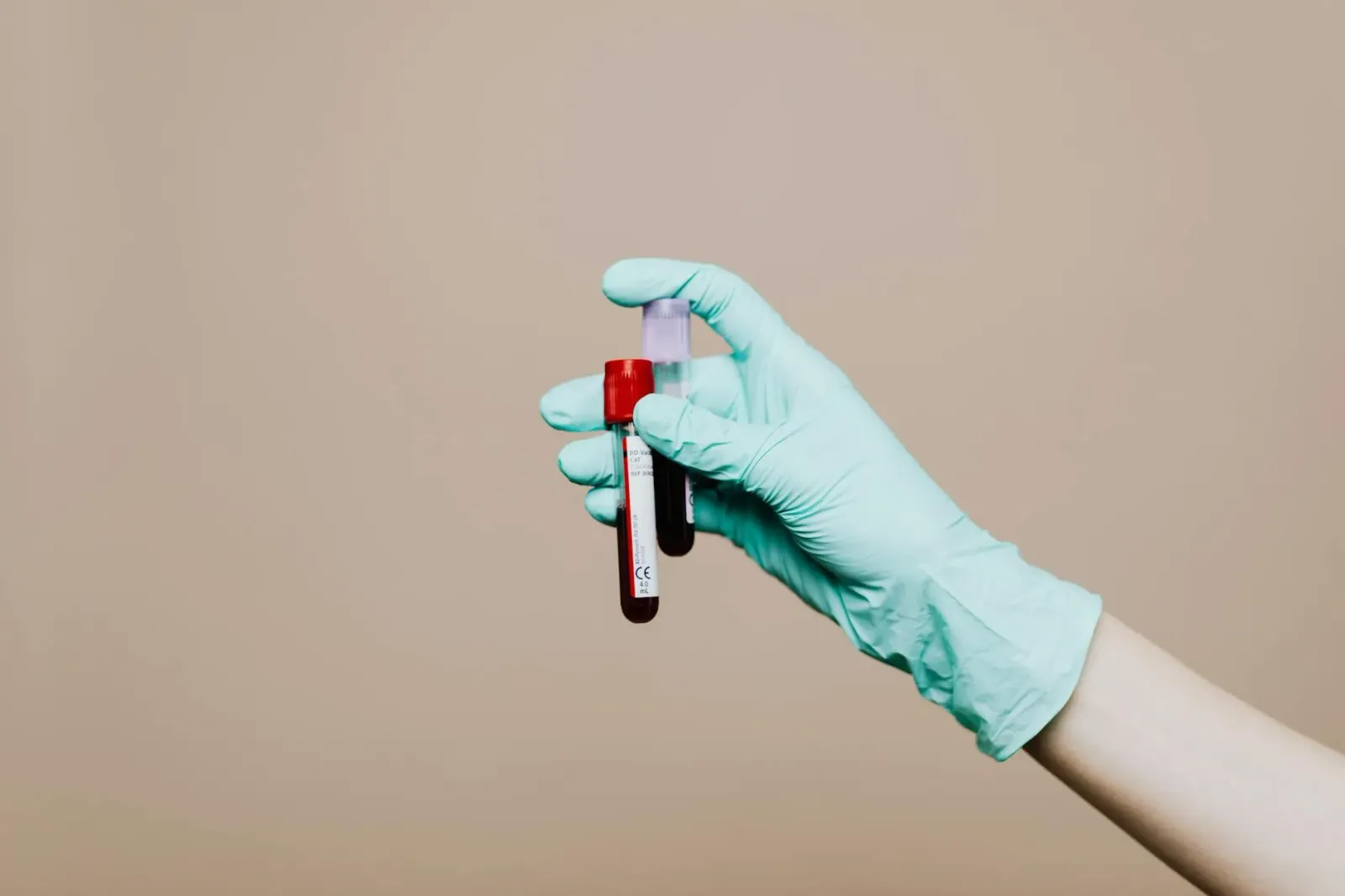 Imajen hatudu amostra ran iha tubu teste, ho fundu korasaun no ekipamentu laboratóriu, atu ilustra teste kolesterol no monito