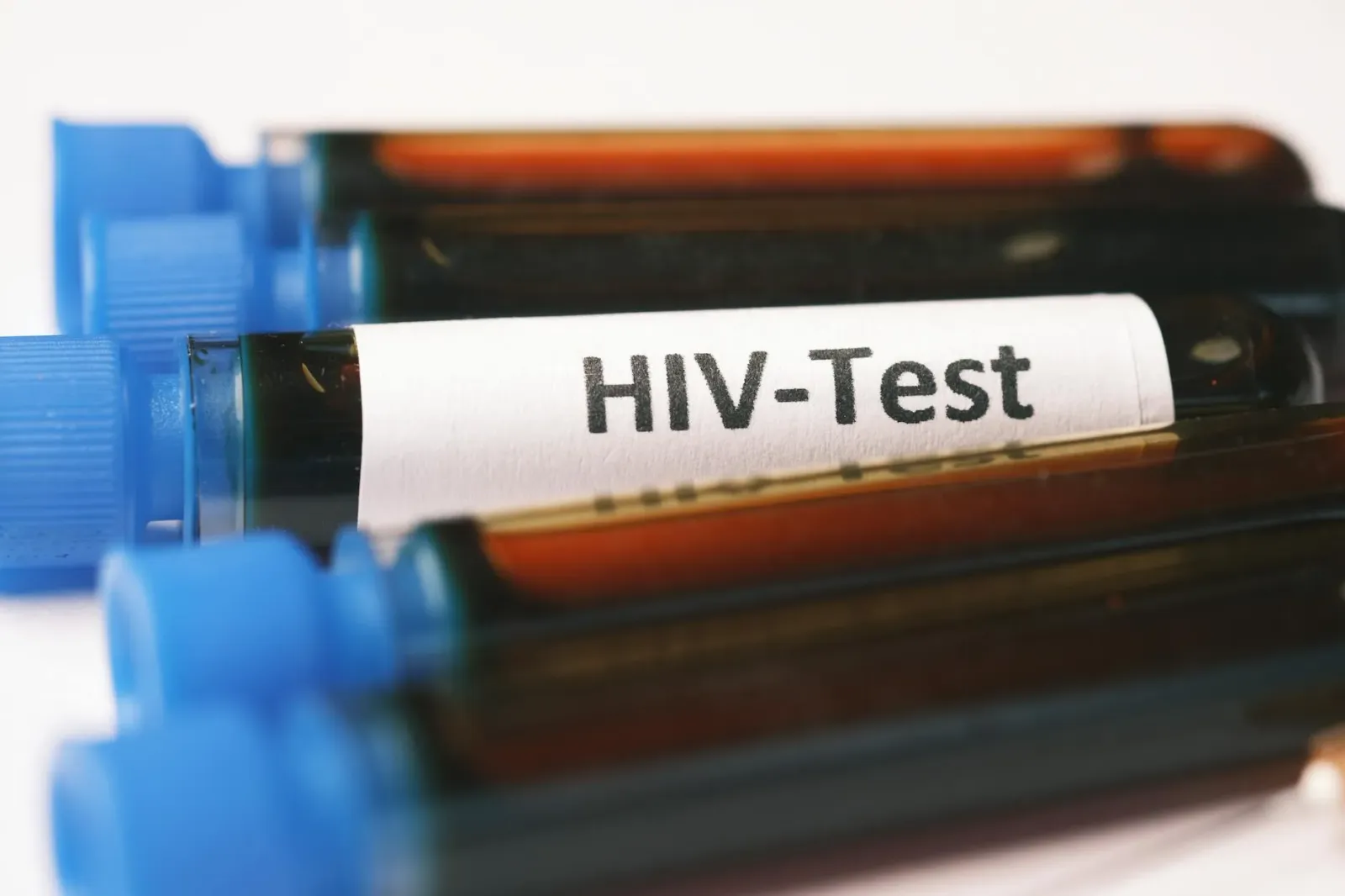Ilustrasaun kona-ba mapa global ho ikon udan, virus HIV, no teknolojia digital saúde, hatudu ligasaun entre desafiu saúde dif