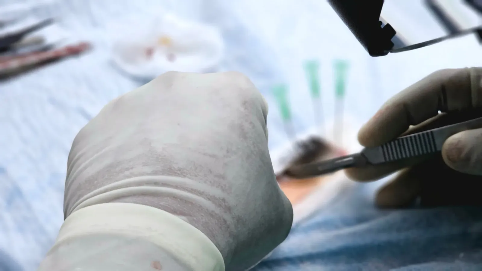 Imagem mak mostra doutor hanesan mediku sira nia sa'ubé no transplantu kidney iha Timor-Leste, nune'e mak sai importante ba i