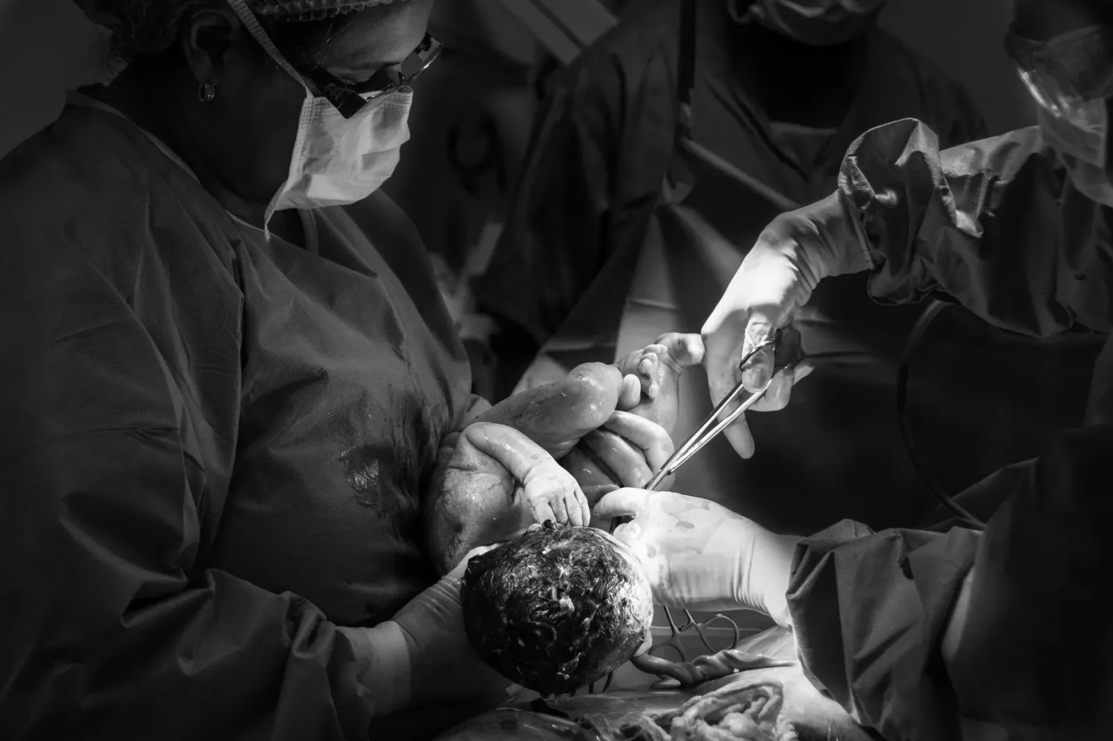 Imajen husi kuartu operasaun iha ospital, ho ekipamentu mediku no doktor sira servisu, hatudu situasaun operasaun C-section n