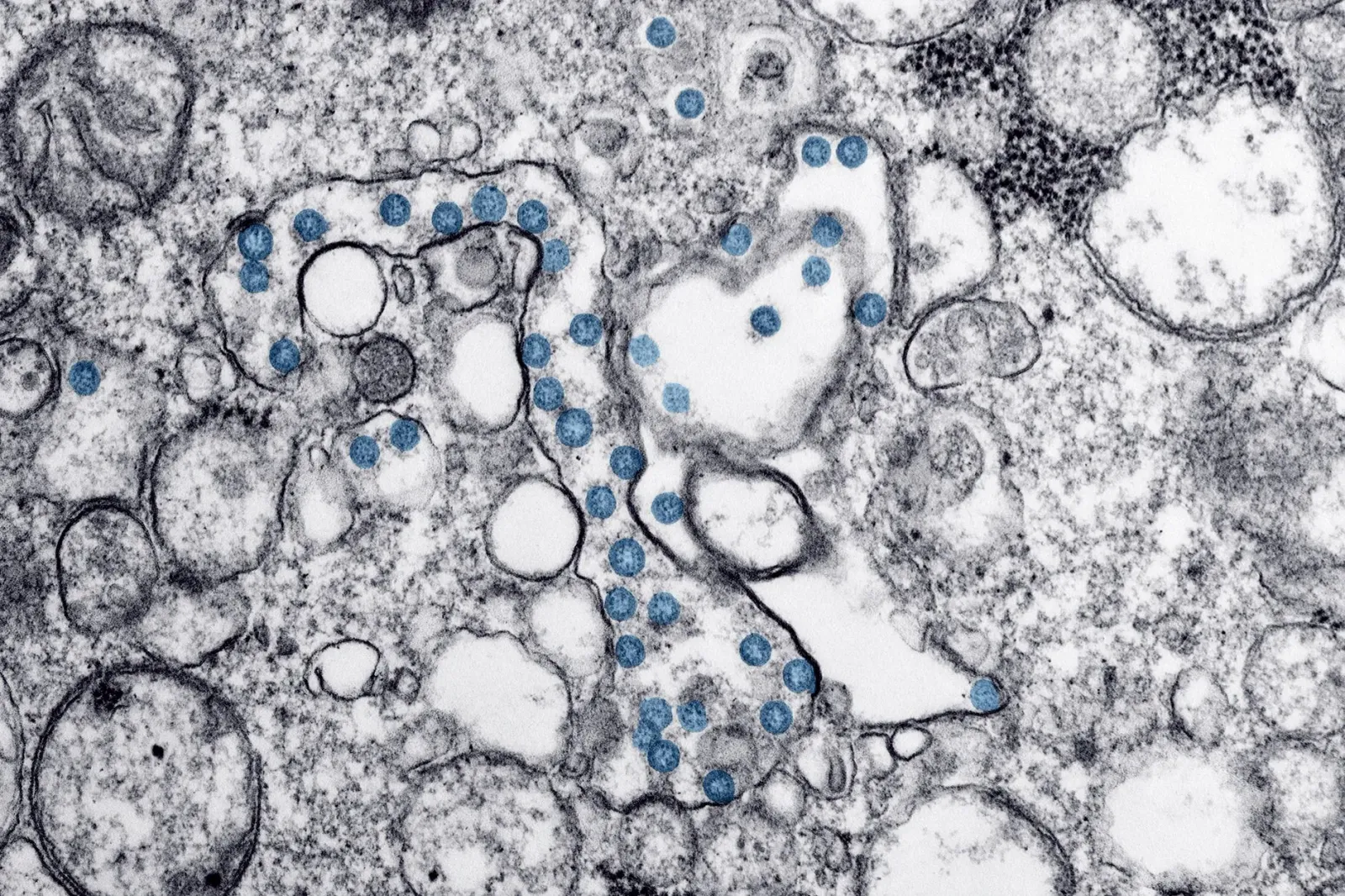 Imajen hosi laboratóriu Rocky Mountain NIH iha Montana, ne'ebé involve iha kazu smuggle virus mpox.