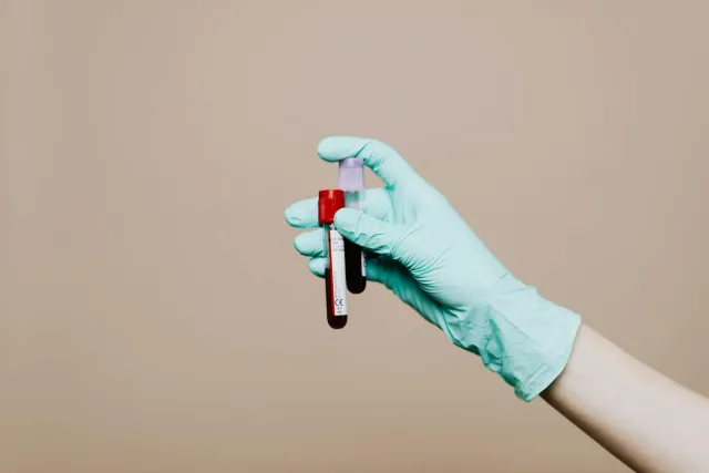 Imajen hatudu amostra ran iha tubu teste, ho fundu korasaun no ekipamentu laboratóriu, atu ilustra teste kolesterol no monito