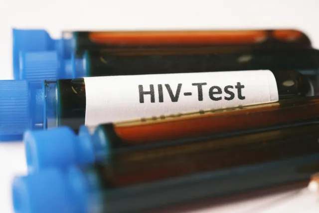 Ilustrasaun kona-ba mapa global ho ikon udan, virus HIV, no teknolojia digital saúde, hatudu ligasaun entre desafiu saúde dif