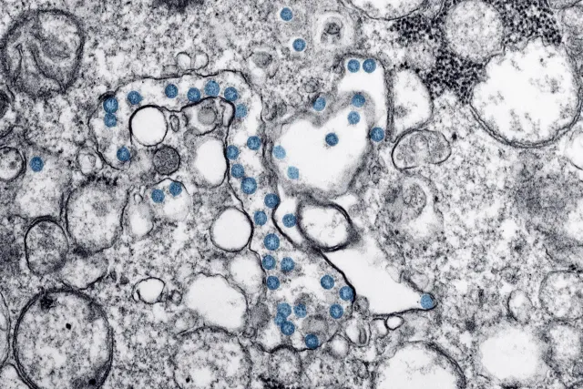Imajen mikroskopiu ne'ebé hatudu virus boot iha rai-polar, ho estrutura kompleksu no kor azul no verde, hanesan sientista sir