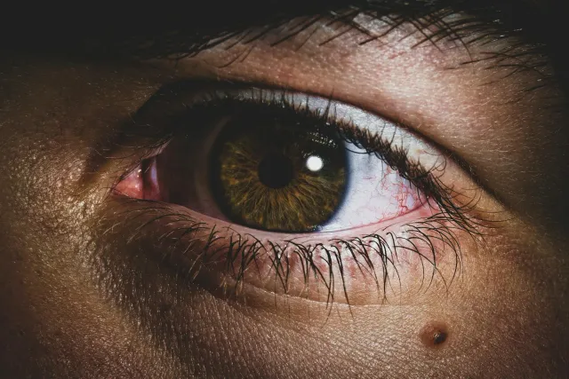 Ilustrasaun kona-ba emerjénsia saúde: matan ho eyelash iha tear duct, tasak bee kontaminadu, no estudante ho hanoin triste, s